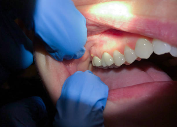  Chanute, KS Emergency Dentist Pros